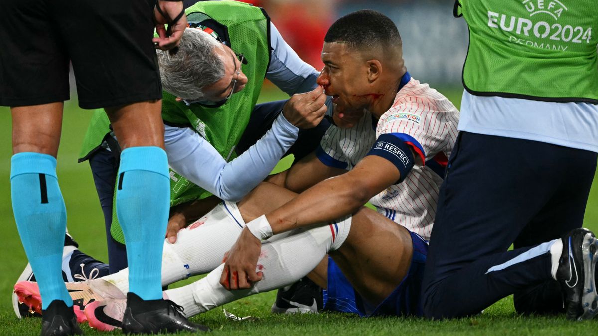 Mbappé imázskampányt csinál az orrtöréséből