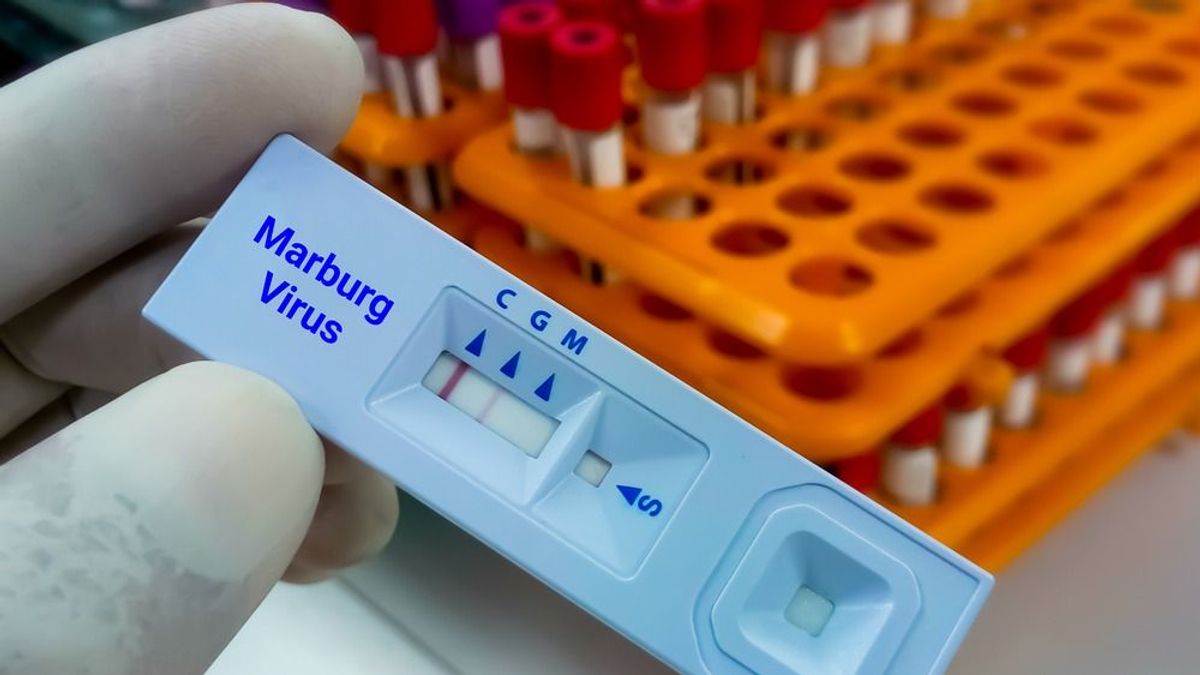 Ettől a vírustól retteg most Európa, ezt lehet tudni a Marburg-vírusról