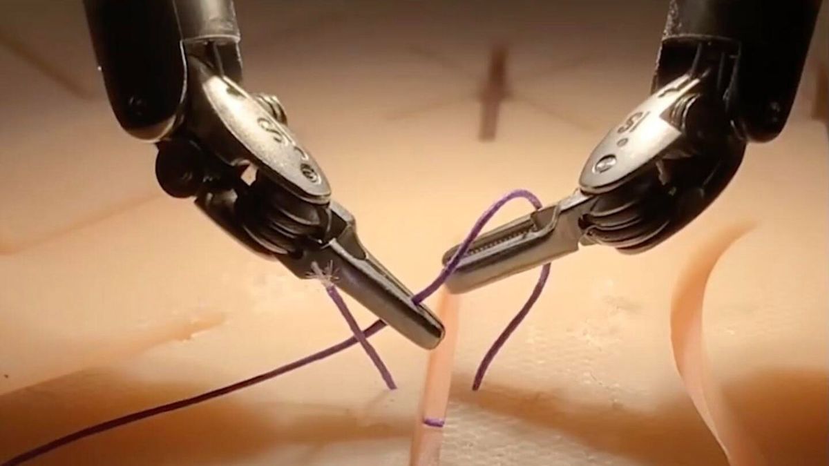 Hogyan műt ez a robot csupán videókból tanulva úgy, mint az emberi orvosok?