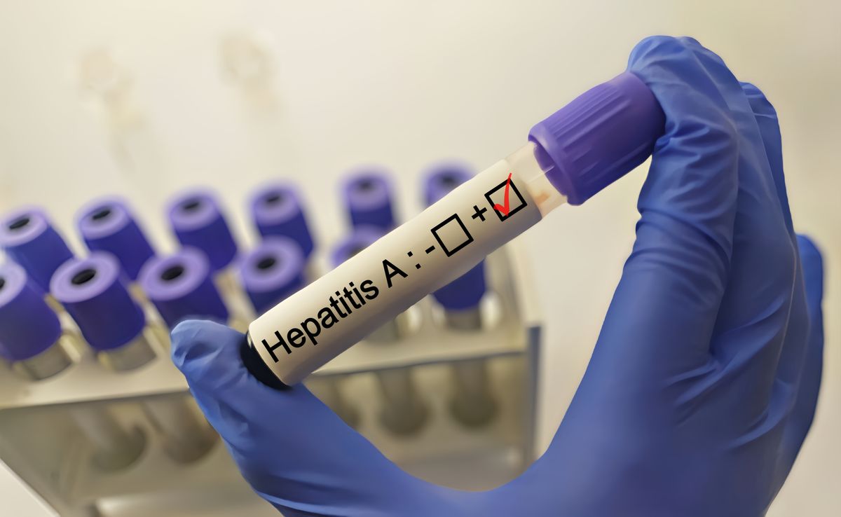 A hepatitisjárvány gyorsan terjedhet az országban