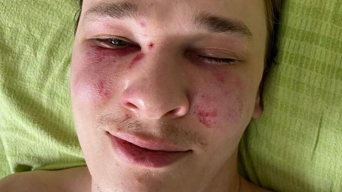 Saját magát verte meg egy fiú a kényszersorozás során az ukrán hatóságok szerint